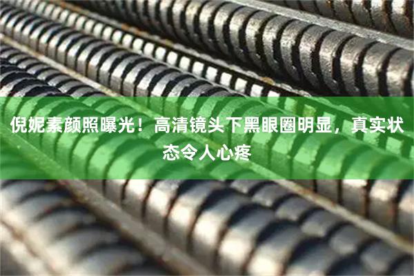 倪妮素颜照曝光！高清镜头下黑眼圈明显，真实状态令人心疼